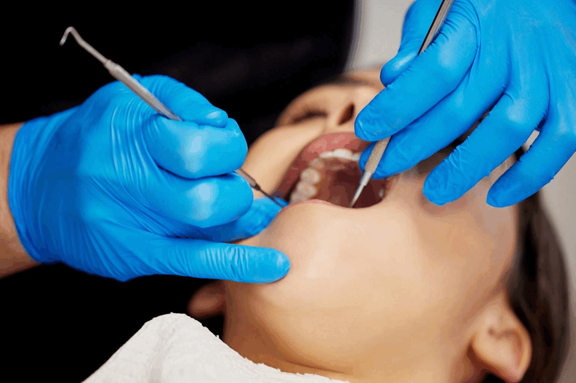 Dental Scaling and Polishing Services Available in Hougang and Little India