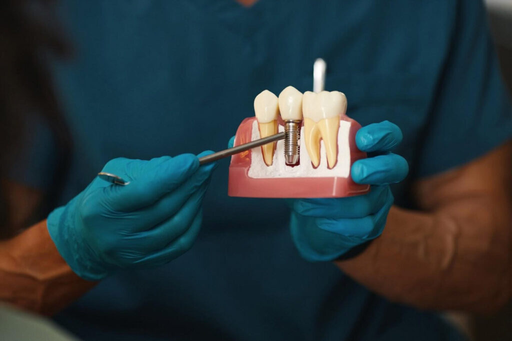 root canal treatment price hougang